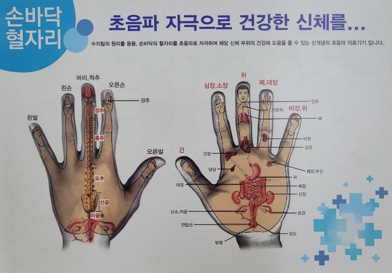 수지침, 뜸 함께해요~!! 썸네일