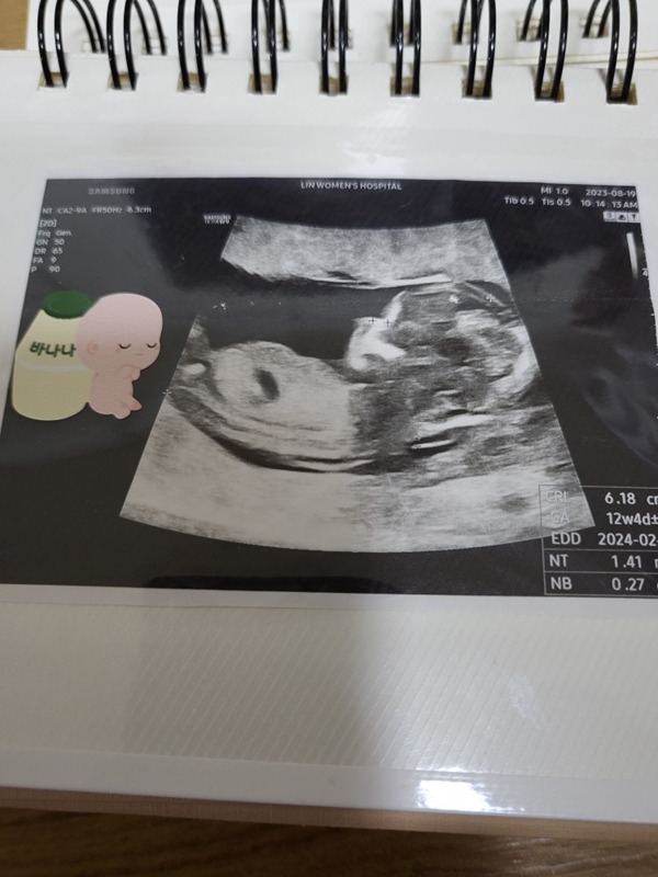 24년 용띠아기 엄마모임  😊 중랑구! 썸네일